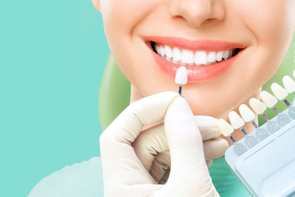 Teeth Whitening in Dubai