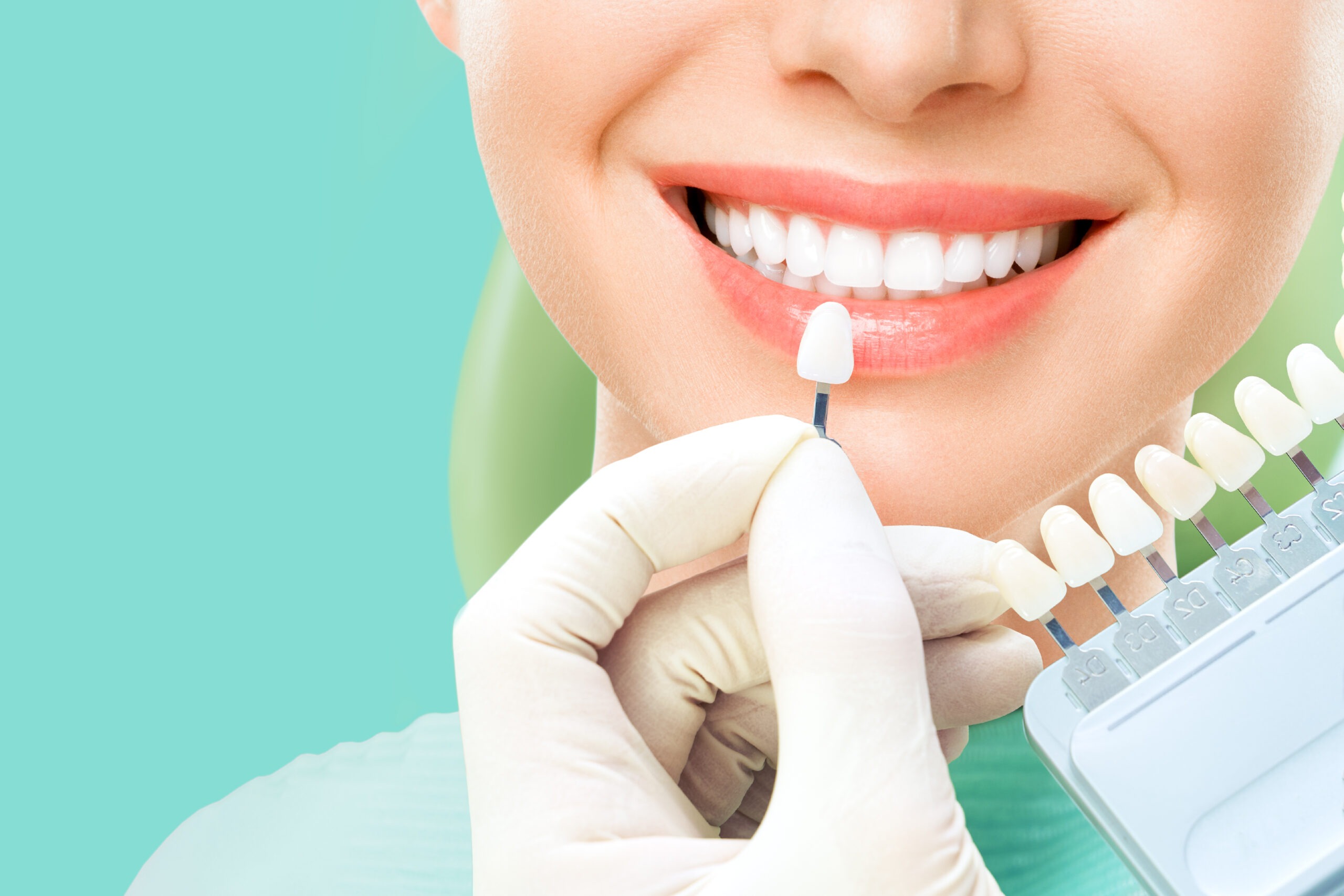 Teeth Whitening in Dubai