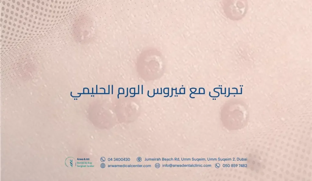 تجربتي مع فيروس الورم الحليمي