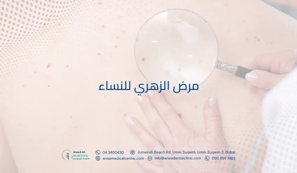 مرض الزهري للنساء