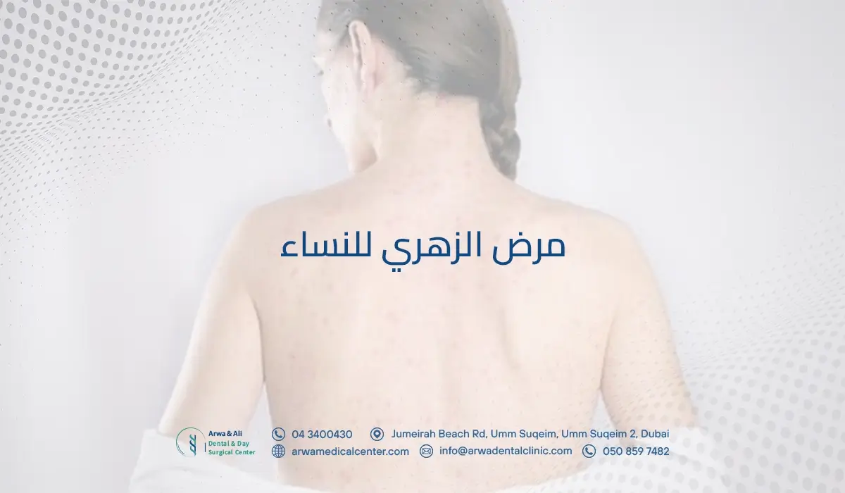مرض الزهري للنساء