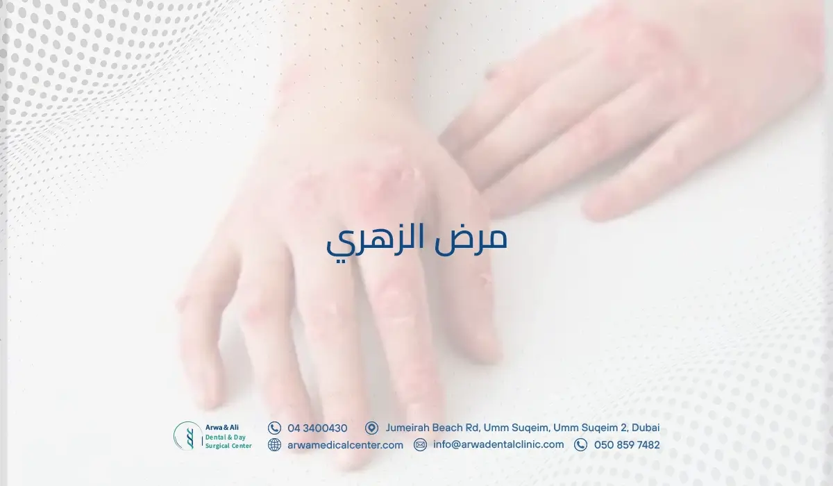 مرض الزهري