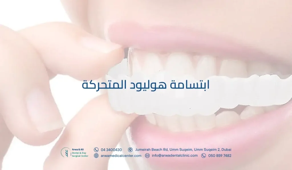 ابتسامة هوليود المتحركة