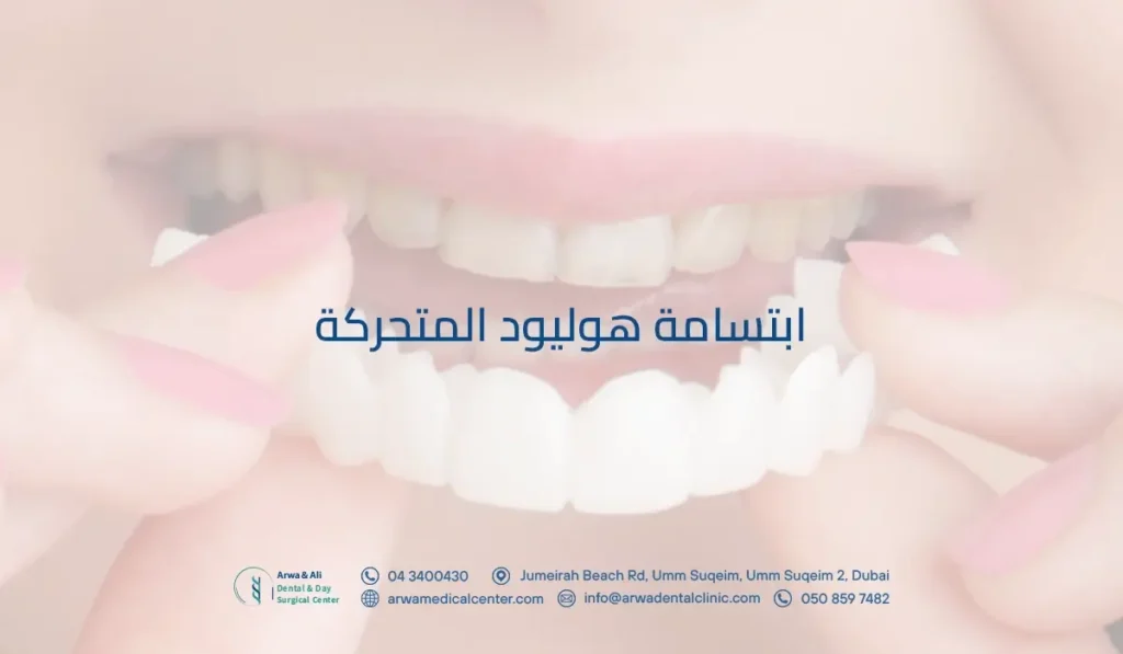 ابتسامة هوليود المتحركة