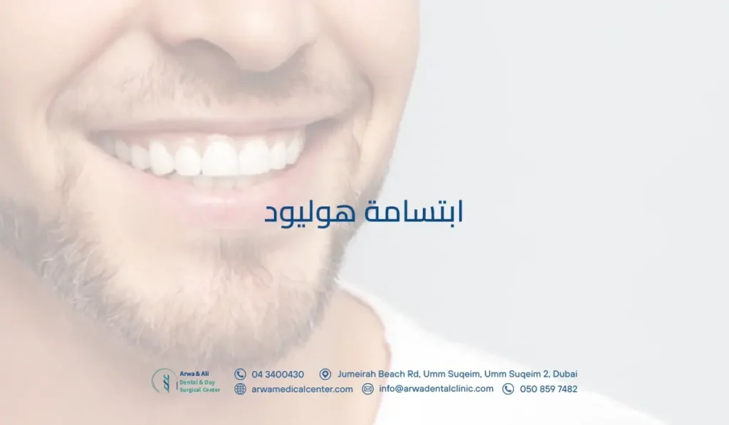 ابتسامة هوليود