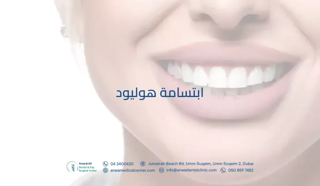 ابتسامة هوليود