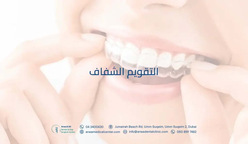التقويم الشفاف