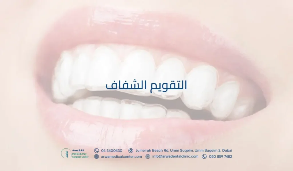 التقويم الشفاف