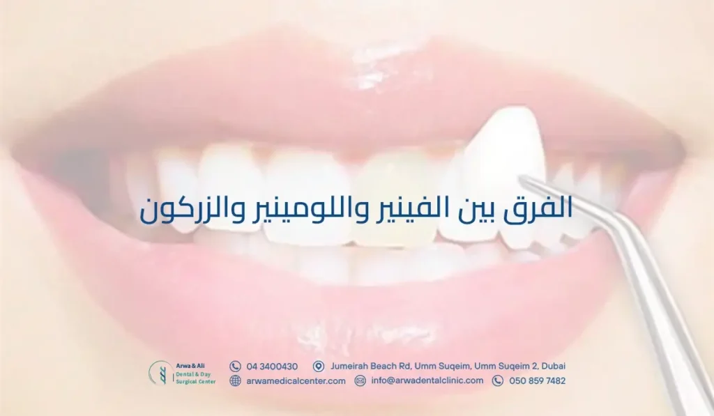 الفرق بين الفينير واللومينير والزركون​