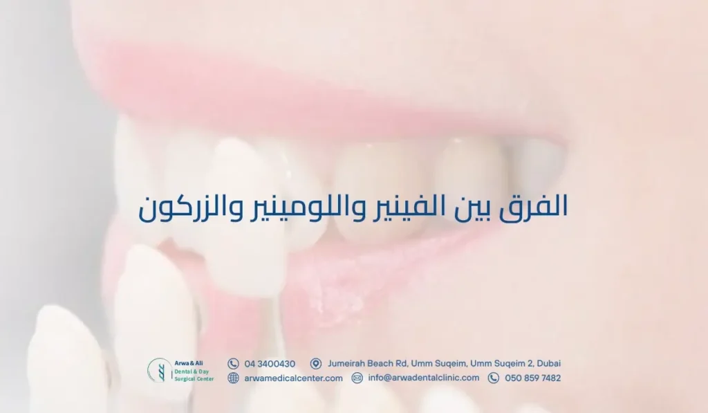 الفرق بين الفينير واللومينير والزركون​