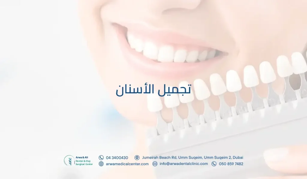 تجميل الأسنان