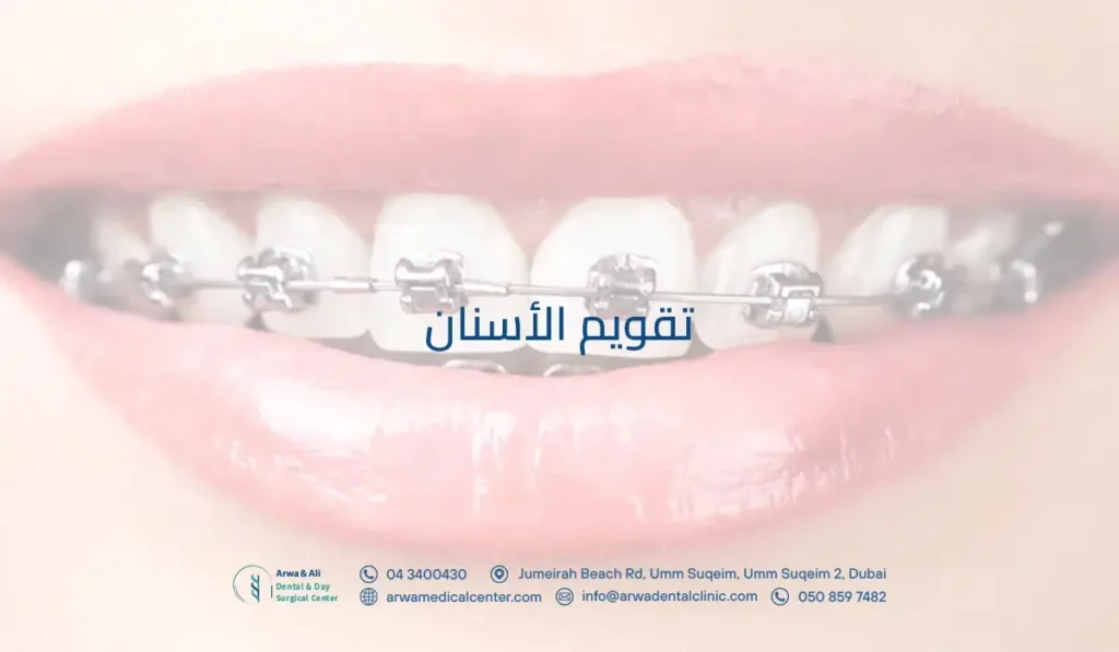 تقويم الأسنان