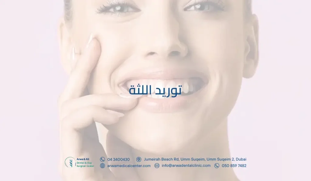 توريد اللثة