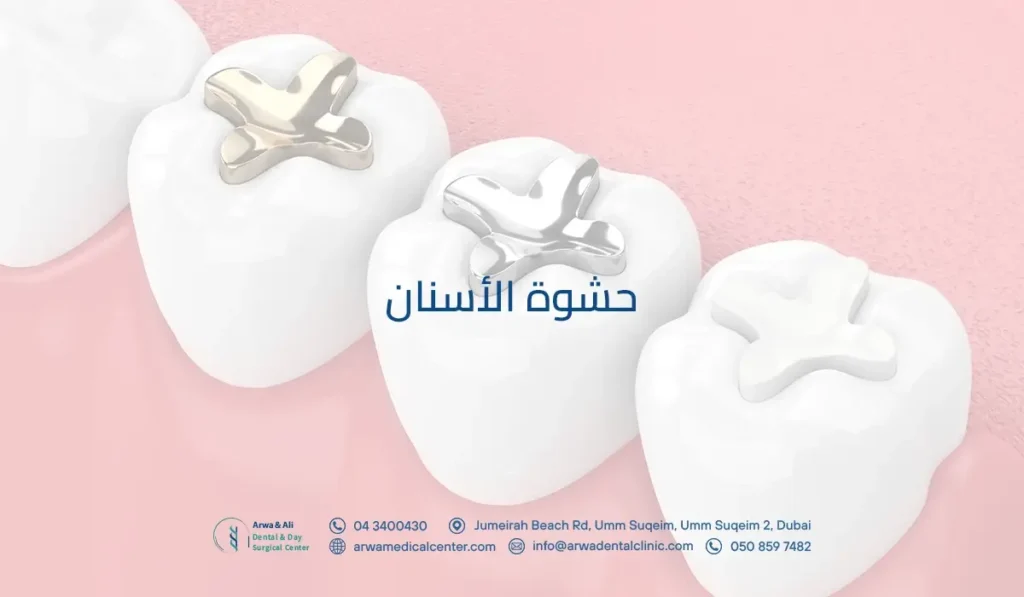 حشوة الأسنان