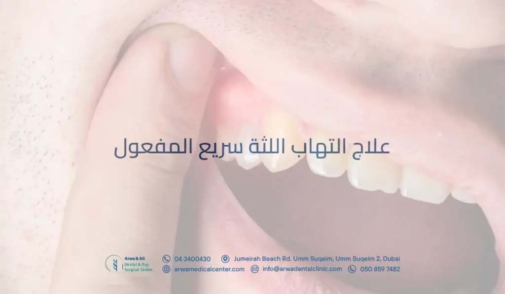 علاج التهاب اللثة سريع المفعول
