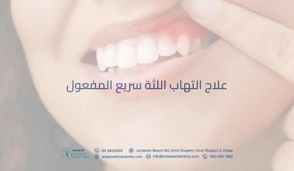 علاج التهاب اللثة سريع المفعول
