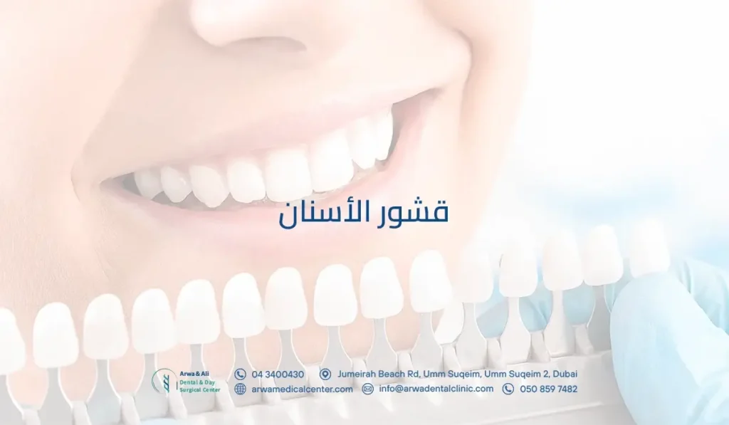 قشور الأسنان