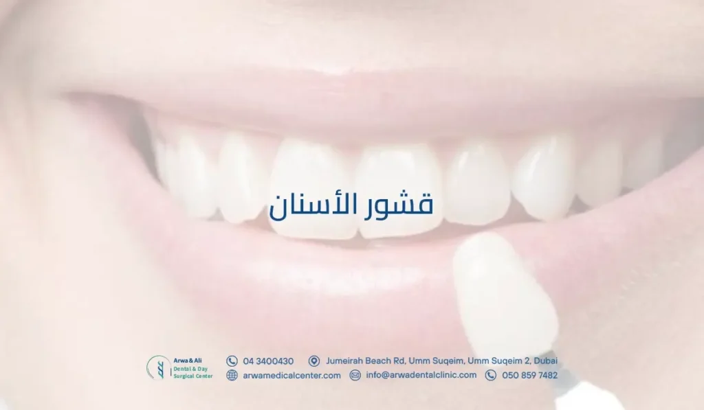 قشور الأسنان