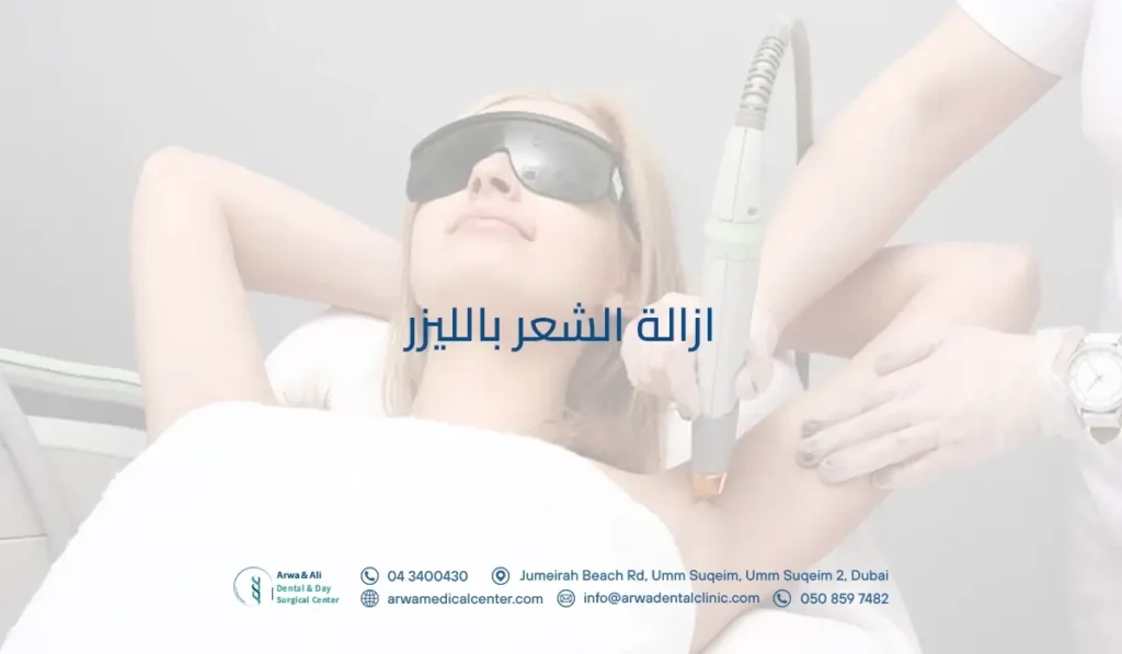 ازالة الشعر بالليزر