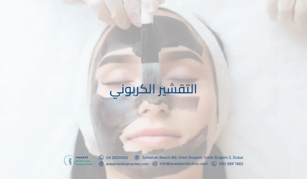 التقشير الكربوني​