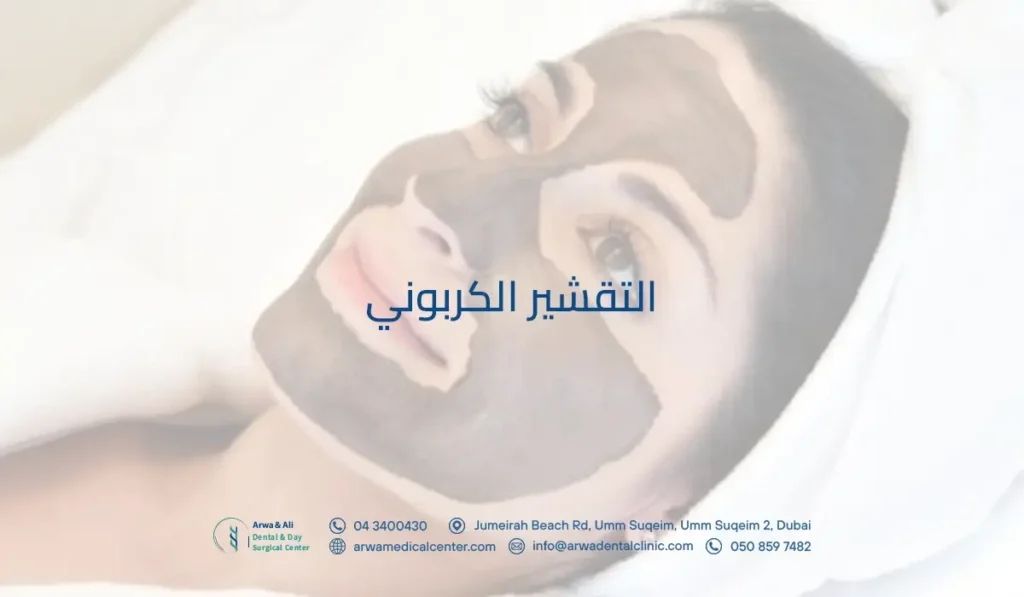 التقشير الكربوني​