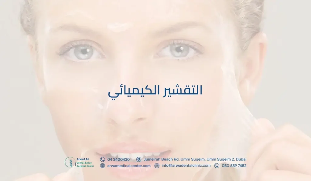 التقشير الكيميائي​