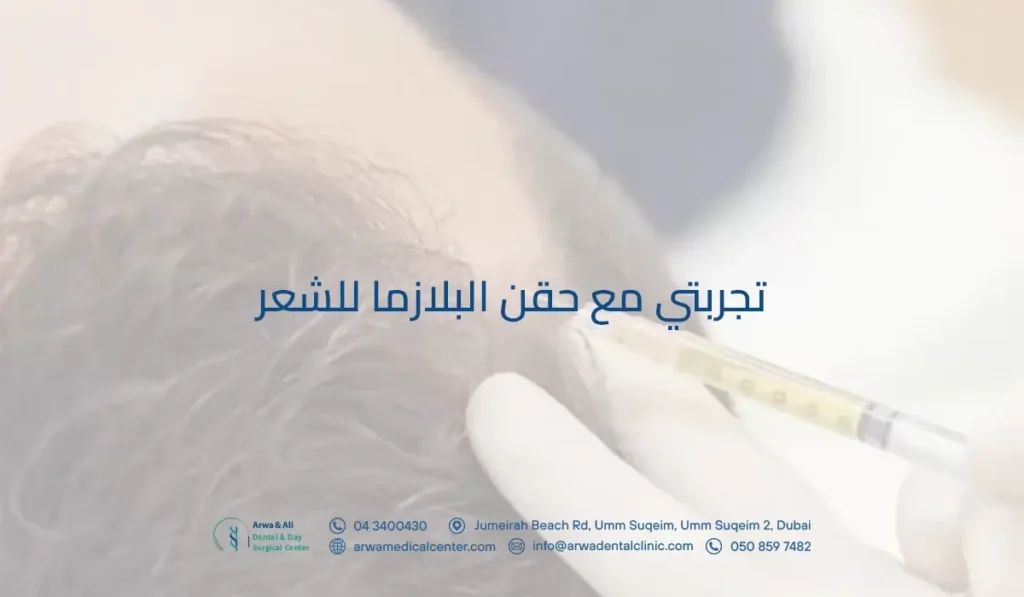 تجربتي مع حقن البلازما للشعر