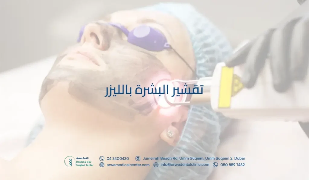 تقشير البشرة بالليزر