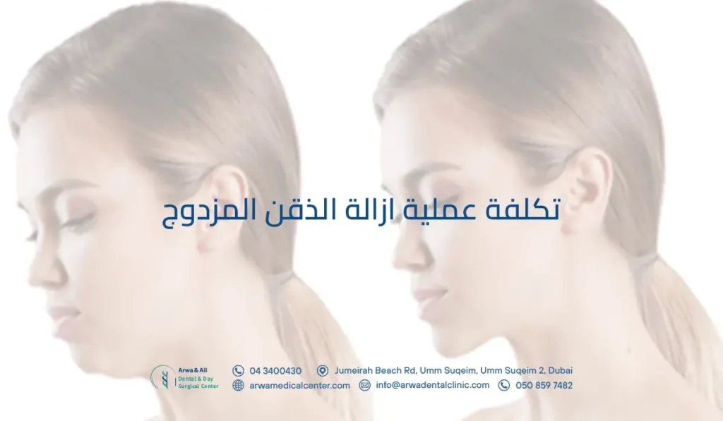 تكلفة عملية ازالة الذقن المزدوج