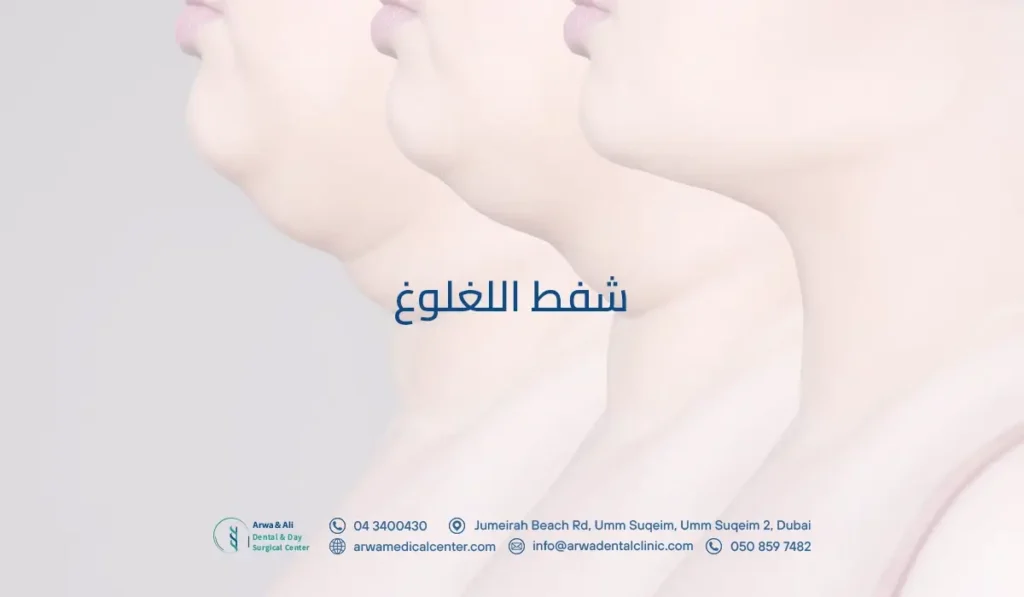 شفط اللغلوغ​