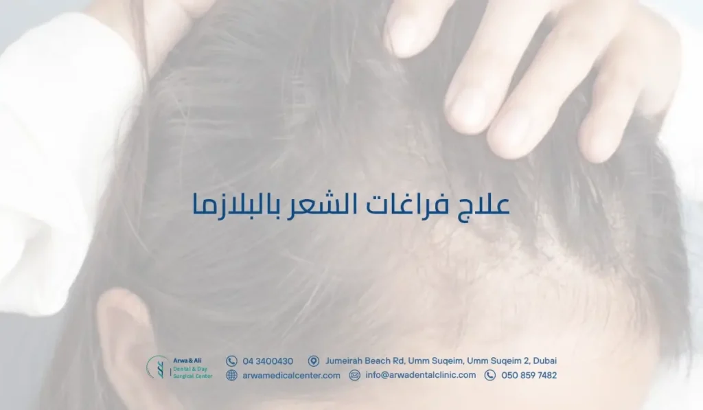 علاج فراغات الشعر بالبلازما