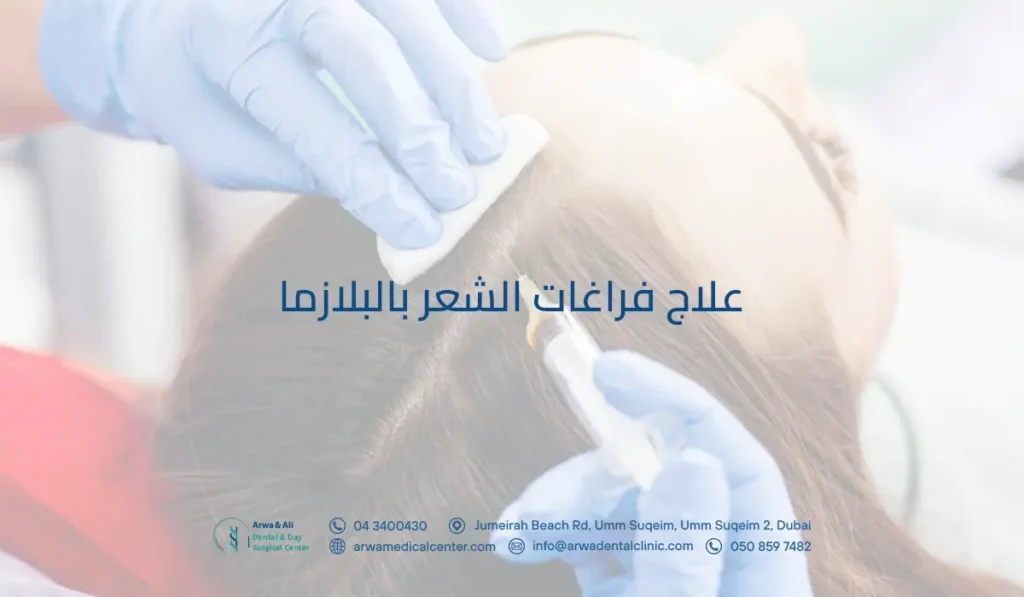 علاج فراغات الشعر بالبلازما