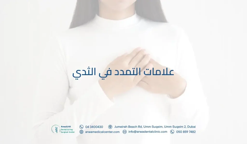 علامات التمدد في الثدي