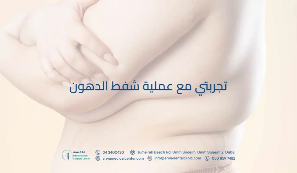 تجربتي مع عملية شفط الدهون