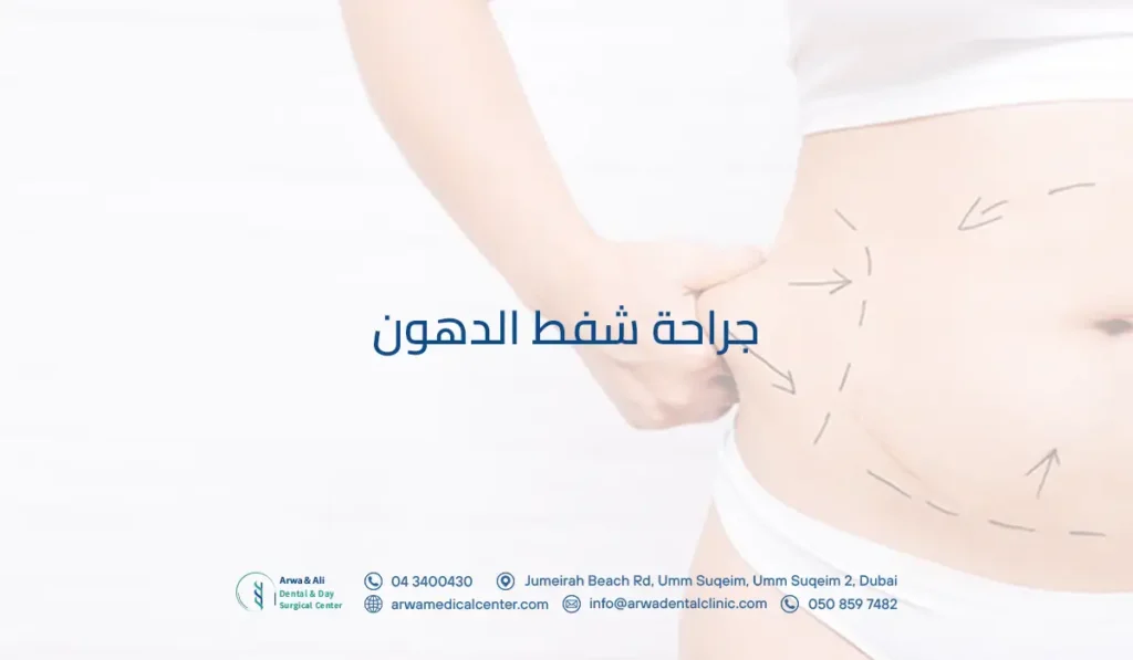 جراحة شفط الدهون