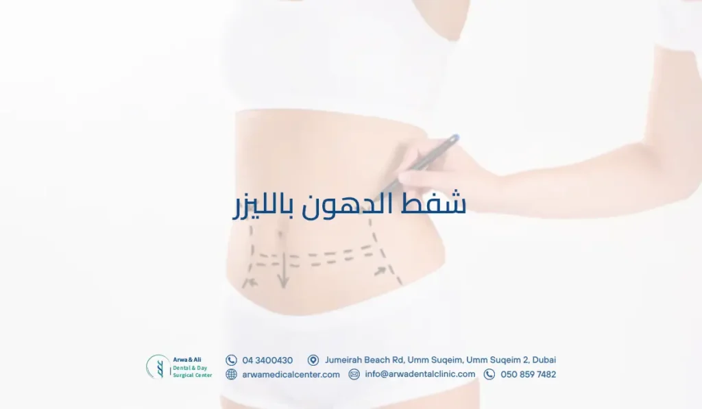 شفط الدهون بالليزر