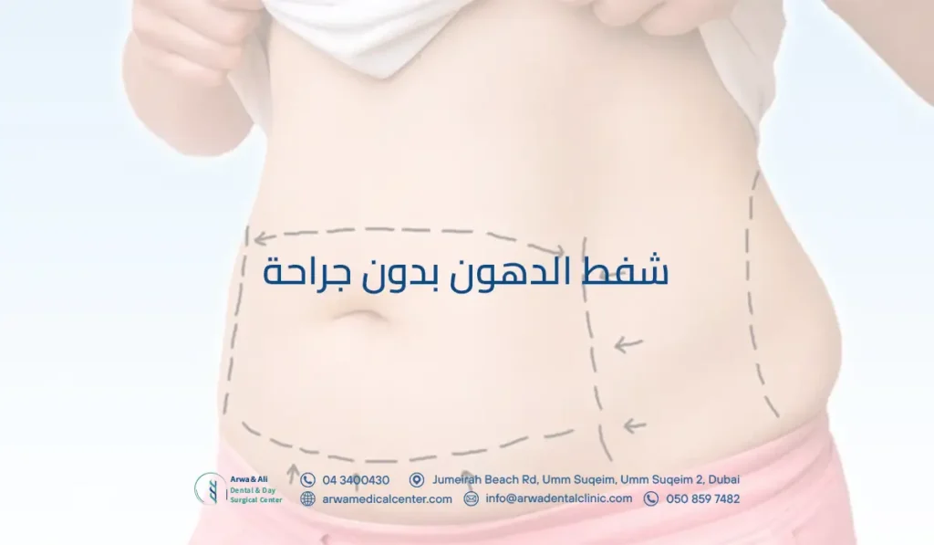 شفط الدهون بدون جراحة
