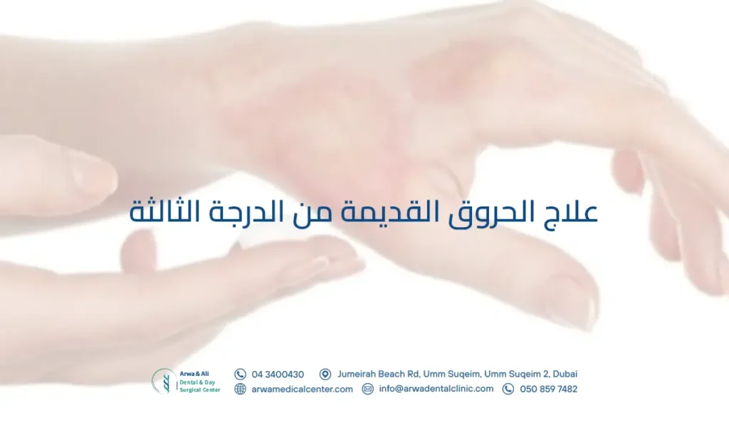 علاج الحروق القديمة من الدرجة الثالثة​
