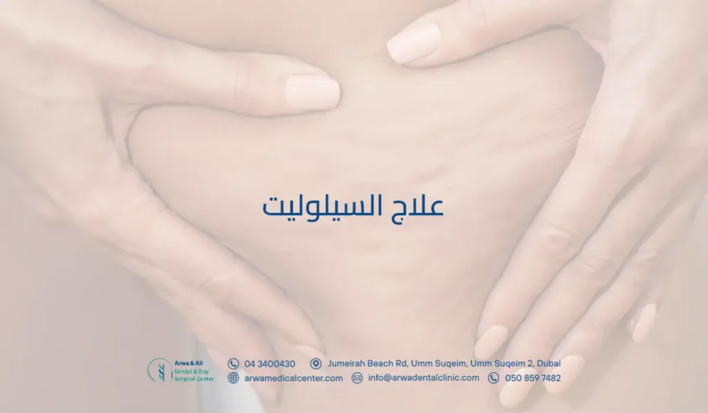 علاج السيلوليت