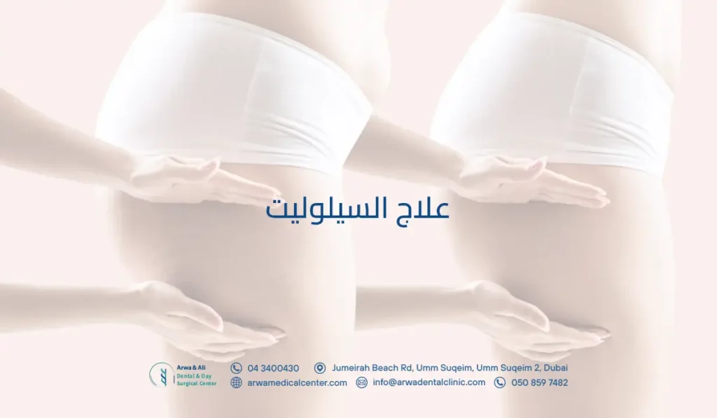 علاج السيلوليت