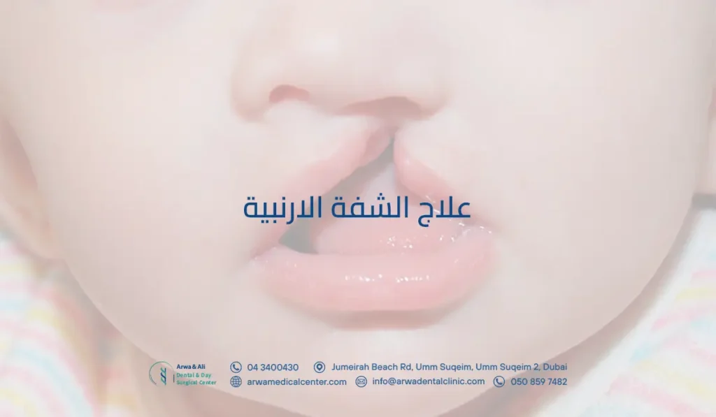 علاج الشفة الارنبية​​