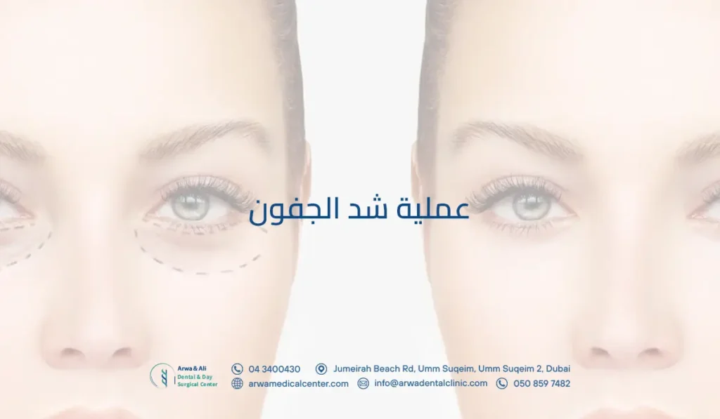 عملية شد الجفون​