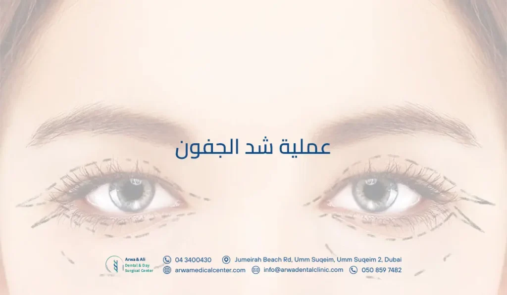 عملية شد الجفون​