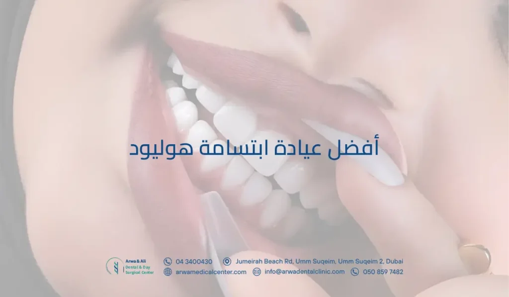 أفضل عيادة ابتسامة هوليود