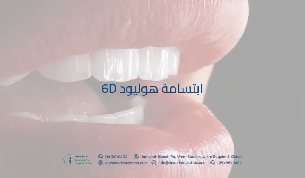 ما مميزات ابتسامة هوليود 6D؟ كم تدوم وكيف تحافظ على نتائجها؟ 3 ابتسامة هوليود 6d