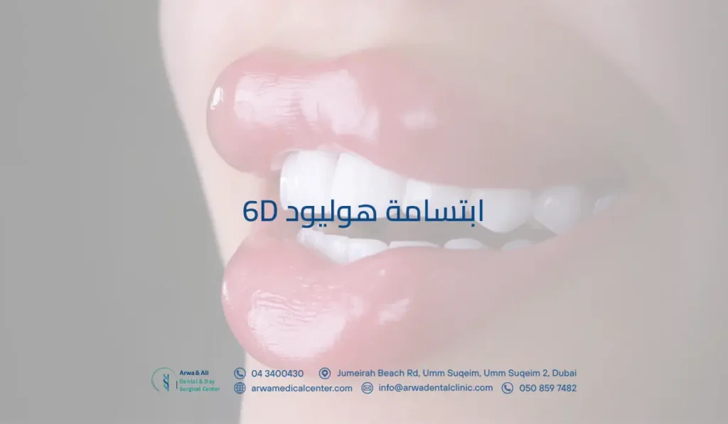 ابتسامة هوليود 6d