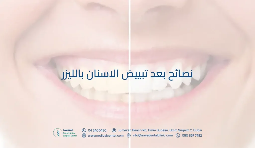نصائح بعد تبييض الاسنان بالليزر: كم يستمر الآلم بعد التبييض؟ 3 نصائح بعد تبييض الاسنان بالليزر