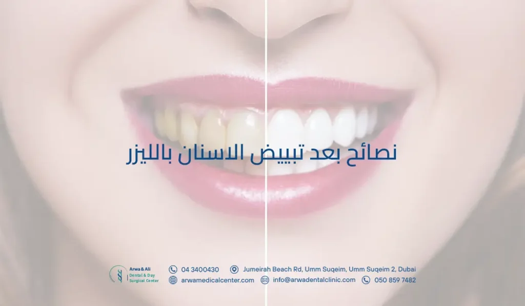 نصائح بعد تبييض الاسنان بالليزر